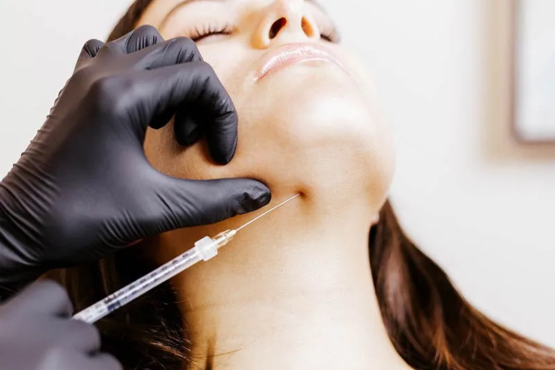 Kybella Injection