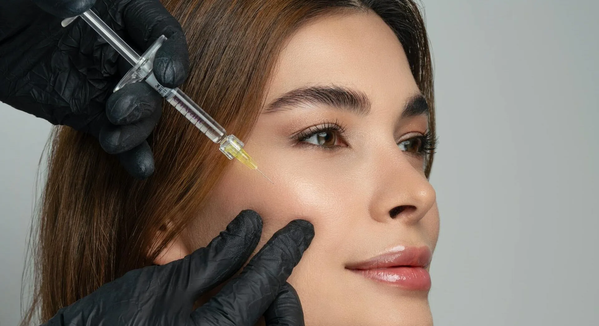 Dermal Filler Dissolution